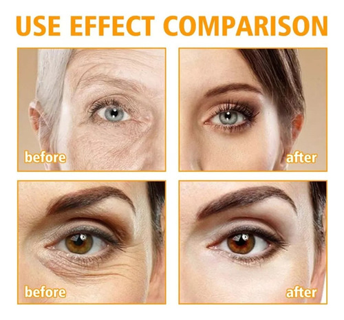 Crema Reafirmante Para Ojos, Elimina Bolsas Y Ojeras