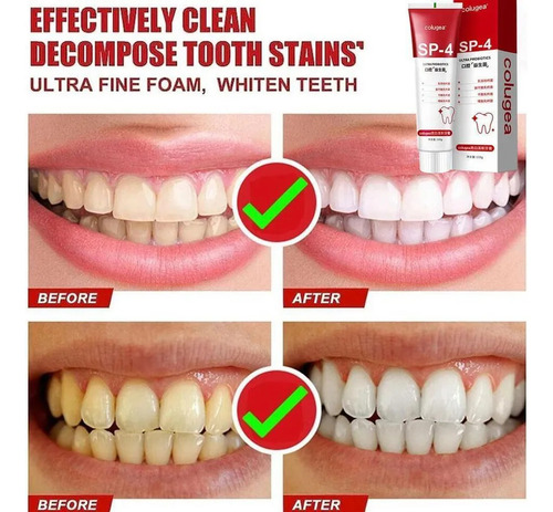 Novo 100g*2, Pasta Dental Blanqueadora Probiótica Sp-4