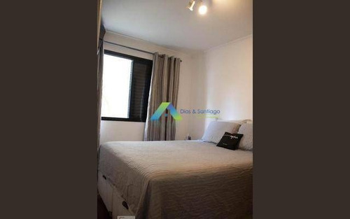 More A 10 Minutos Da Estação Do Metro Praça Da Arvore Apartamento, 2 Ddormitorios, 1 Vaga, E Lazer Com Otimo Valor !! - Ap5209