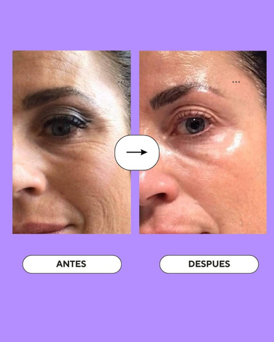 Sérum Retinol Ipky 50 Ml - Exfoliante Facial 25+