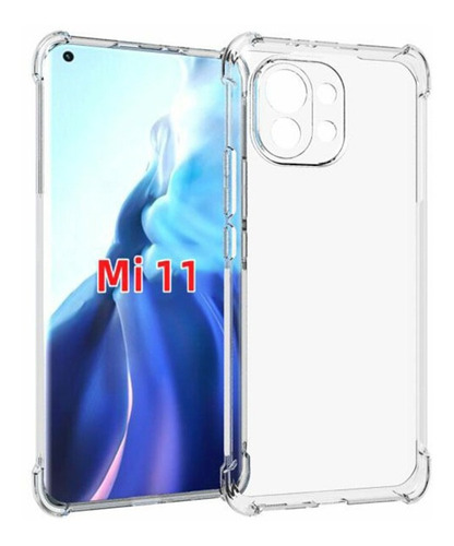 Estuche Protector Tpu Para Xiaomi Mi 11  Mi 11 Lite