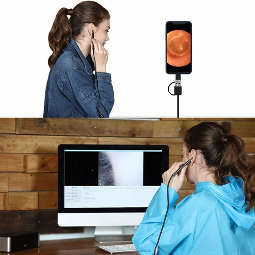 Imagen 5 de 7 de Otoscopio Digital, Cámara De Oídos Para Usar En Pc Y Celular