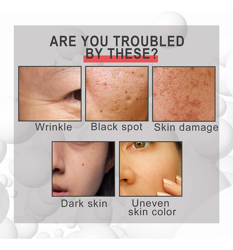 Antiarrugas Suero Corrector De Manchas En La Piel Suero 30ml