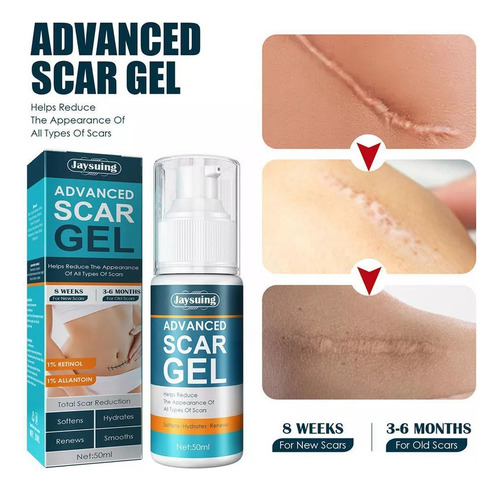 2 Peças De Gel De Creme Para Remoção De Estrias E Cicatrizes