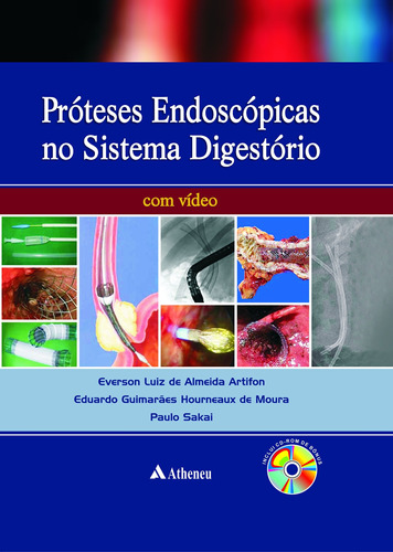 Próteses endoscópicas do aparelho digestório, de Moura, Eduardo Guimarães Hourneaux de. Editora Atheneu Ltda, capa mole em português, 2012