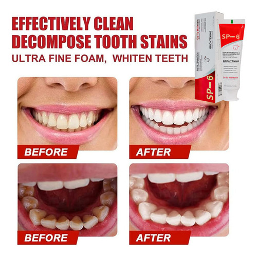 Pasta De Dientes Blanqueadora Probiótica Sp-6 De 2 Unidades*