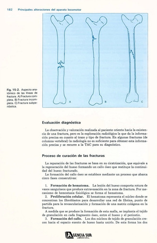 Enfermería Medico Quirúrgica, Necesidad De Movimiento