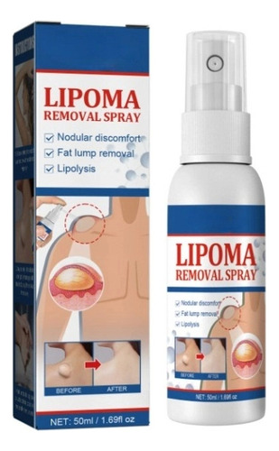 Productos Para El Cuidado De La Piel Lipoma Fatty Knot En Ae