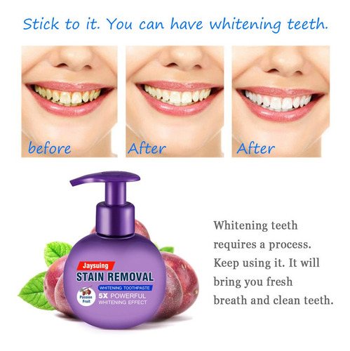 Sf Stain Removal Pasta Dental Blanqueadora Lucha Contra El S