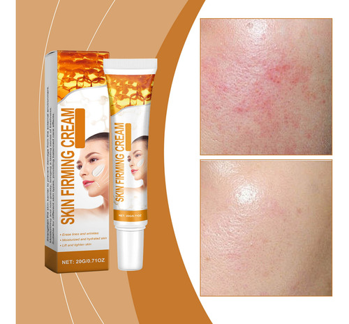 Crema Antiarrugas Hidratante Antiarrugas C Bee Venoms 2001