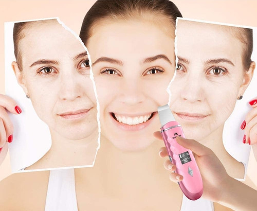 Imagen 2 de 2 de Peeling Ultrasonico Belleza Spa Facial