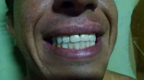 Protéticobom Laboratório De Prótese Dental