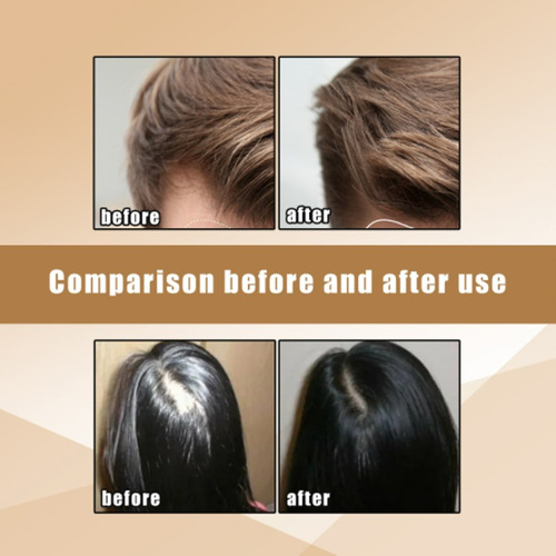 7 Barras De Xampu De Gengibre Para O Crescimento Do Cabelo
