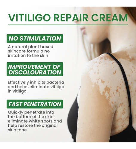 Hh Crema Reparadora De Manchas De Vitíligo