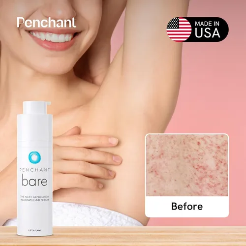 Tratamiento Para Vellos Encarnados De Penchant Bare, La Mejo
