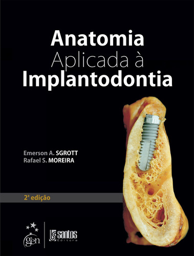 Anatomia Aplicada à Implantodontia, de Moreira, Rafael S.. Editorial Livraria Santos Editora Comércio e Importação Ltda., capa mole em português, 2013