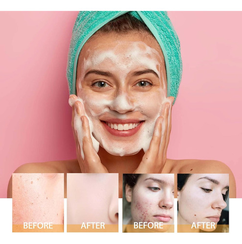Turmeric Exfoliating Set | Brush, Glow For All Skin,1 Pcs
