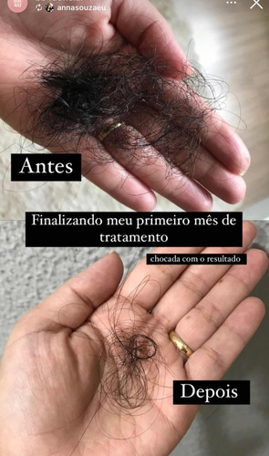 Suplemento Bb4u - Kit 3 Unidades