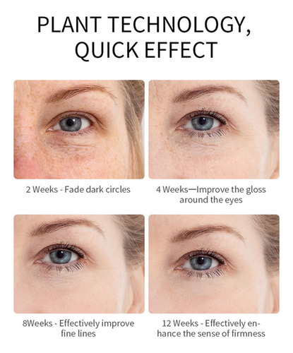 Inchaço Nos Olhos, Olhos Inchados Com Cafeína, Creme Reparad