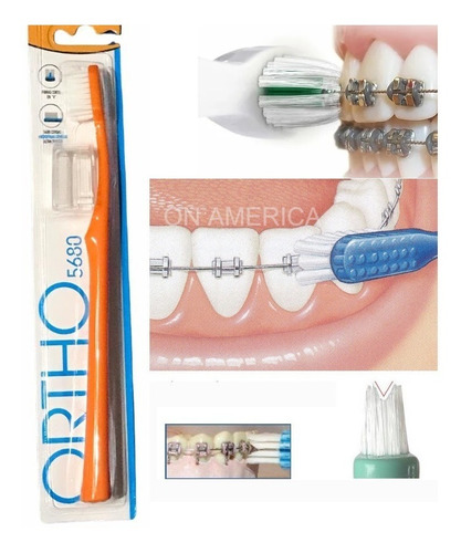 Cepillo Dental Para Ortodoncia Corte En V Suave Celeste