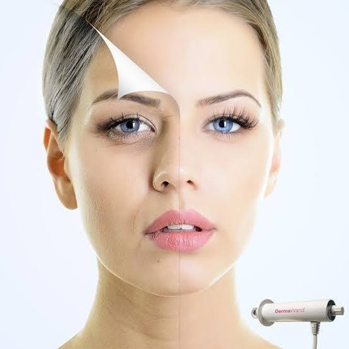 Derma Wand Nuevo Sin Caja
