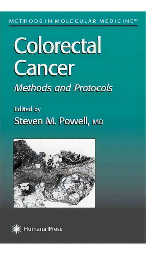 Colorectal Cancer, De Steven M. Powell. Editorial Humana Press Inc, Tapa Blanda En Inglés