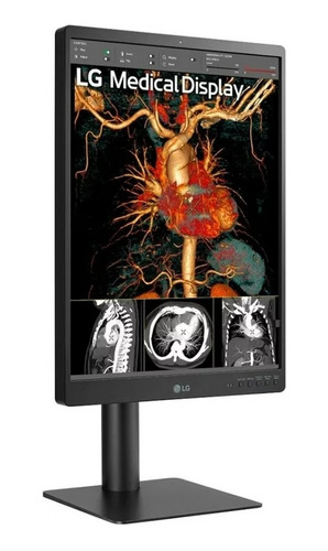 Monitor LG De Diagnostico 21.3` Ips 3mp Multi-resolucion