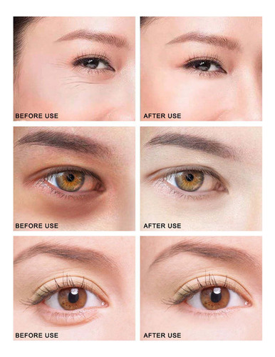 Máscara Para Ojos Golden Lady, Hidratante, Aclaradora, Circu