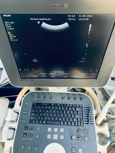 Ultrassom Philips Clearvue 550 Gineco Obstetrícia Vascular