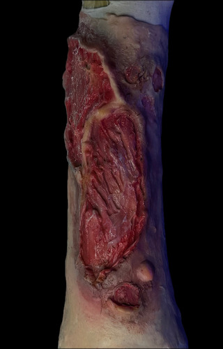 Quemadura 3 Grado Manga Silicona Simulacros Piel Artcreationsfx