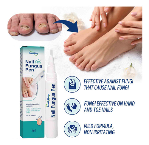 Para Melhorar As Unhas Dos Pés, Unhas E Pés Infectados 3ml