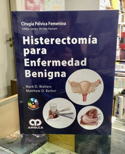 Histerectomía Para Enfermedad Benigna.