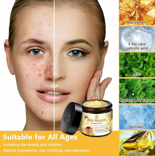 Crema Para El Tratamiento De La Piel De Abeja, Reduce Eficaz