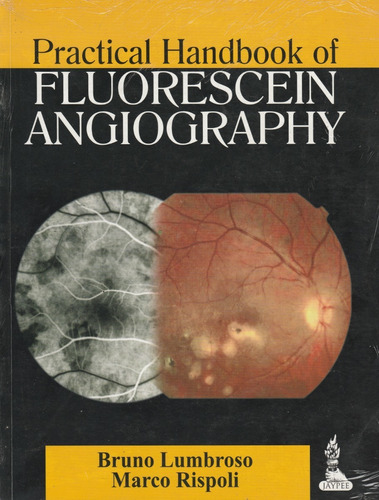 Practical Handbook Fluorescein Angiography Bruno Lumbroso