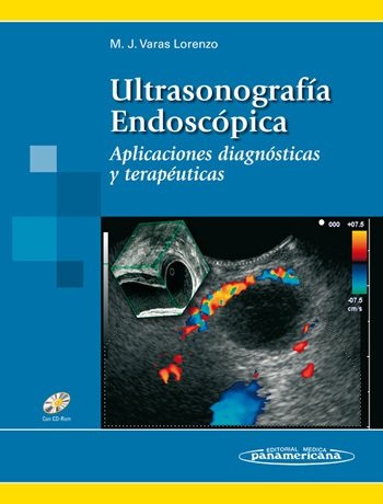 Varas:ultrasonografæa Endoscùpica (libro Original)