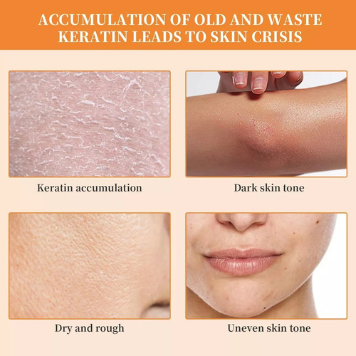 Gel Exfoliante Orange Enzymes, Exfoliante Facial Y