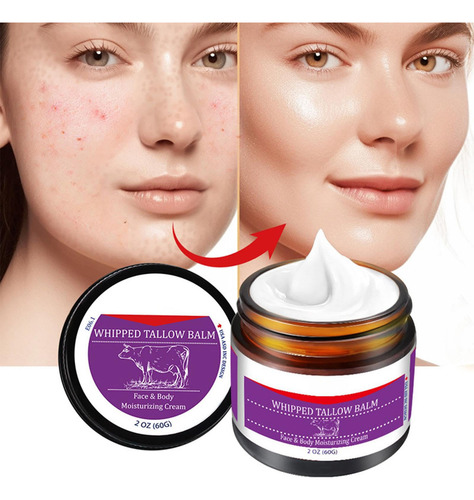 Crema Hidratante Facial X Tallow, Sebo De Ternera Para 60 G,