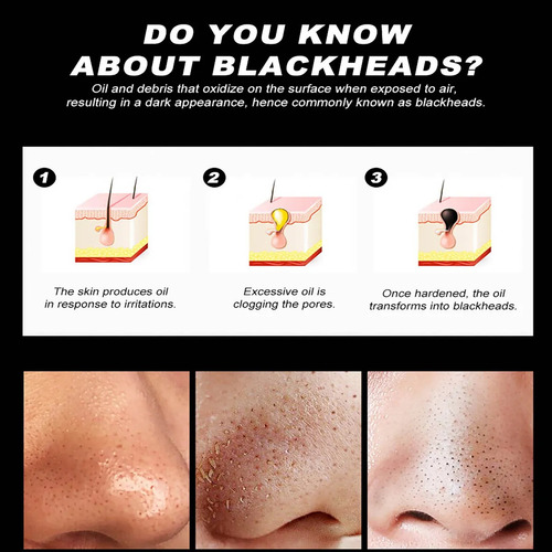 Mascarilla Nasal Head Remover W Mascarilla Nasal Ting M
