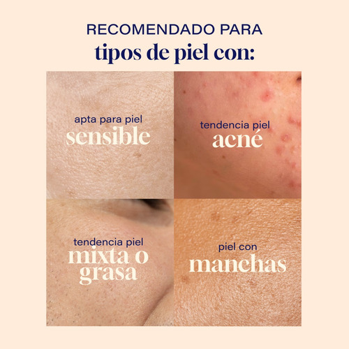 Imagen 6 de 7 de Tonico Facial 500ml Niacinamida Colageno Skin Care Toner
