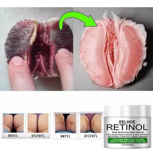 Retinol Crema Aclaradora Zona Intima Cuello Codos Rodillas Todo Tipo De Piel Día/noche