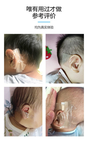Corrector Estético De Oreja De Bebé Recién Nacido 50 Cm 4 Pz