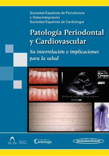 Sepa - Patología Periodontal Y Cardiovascular