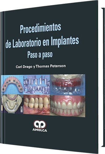 Procedimientos De Laboratorio En Implantes Paso A Paso 