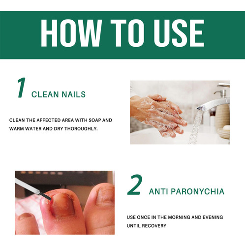 Solução De Reparo De Unhas Cinza Esmalte Para Unhas Para Pés