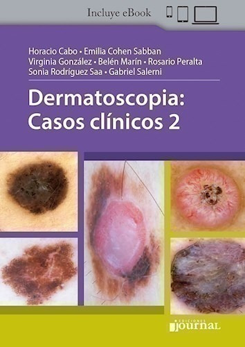 Dermatoscopia: Casos Clínicos 2 - Cabo, Horacio (papel)