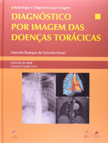 Radiologia e Diagnóstico por Imagem - Diagnóstico por Imagem das Doenças Torácicas, de Funari, Marcelo Buarque de Gusmão. Editorial Editora Guanabara Koogan Ltda., capa mole em português, 2012