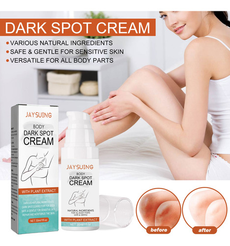 Removedor Para Tratamento De Hiperpigmentação Em Creme De Co