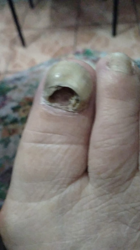 Imagen 4 de 5 de Auriculoterapia Y Podologia Basica
