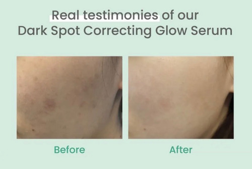 Axis-y Dark Spot Correcting Glow Serum 50ml - Niacinamida Mo