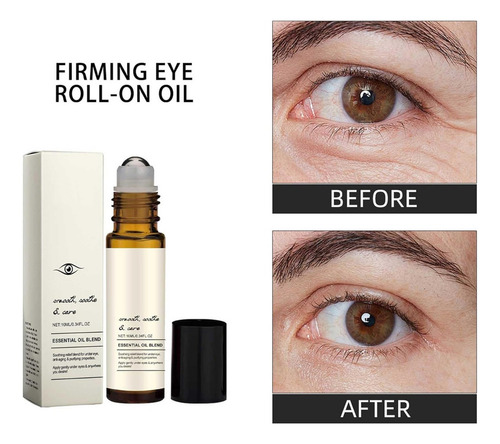 Rodillo For Ojos Con Aceite De Ricino E Incienso, Rodillo